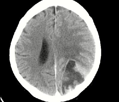 Brain 114