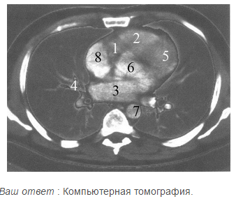 Методы рентгенологического исследования сердца и сосудов
