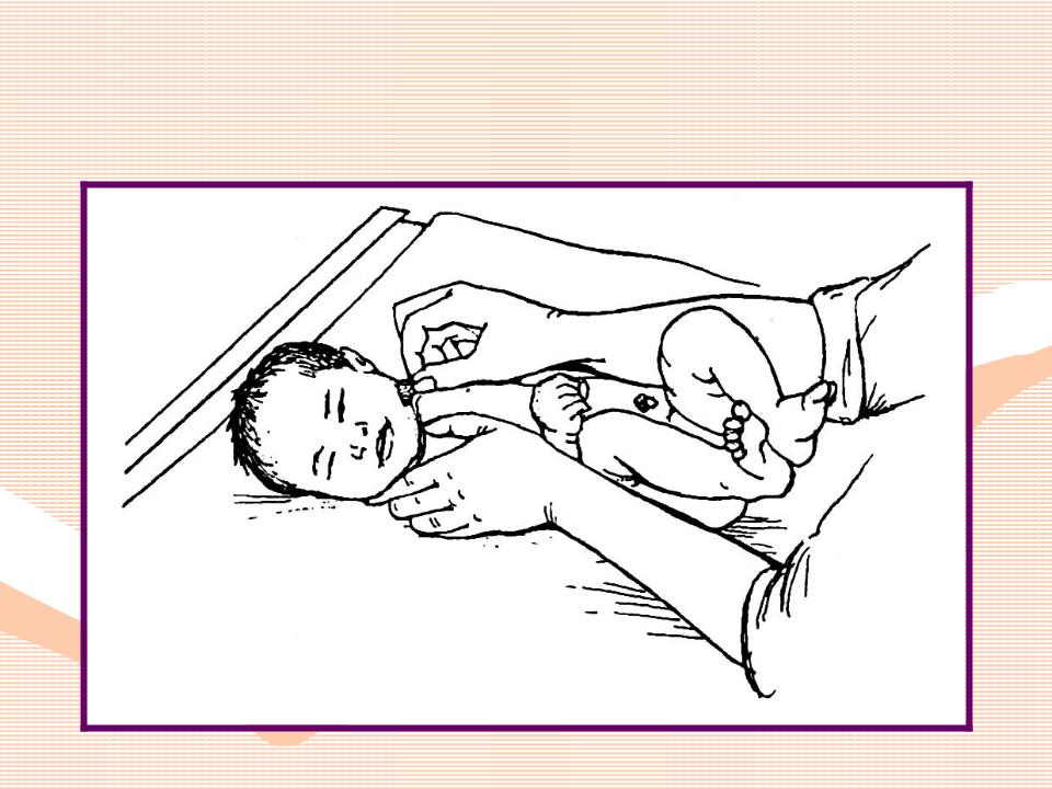 Проведение утреннего туалета новорожденному ребенку. Туалет глаз новорожденного алгоритм. Проведение утреннего туалета грудного ребенка. Утренний туалет новорожденного и грудного ребенка. Проведение туалета новорожденного.
