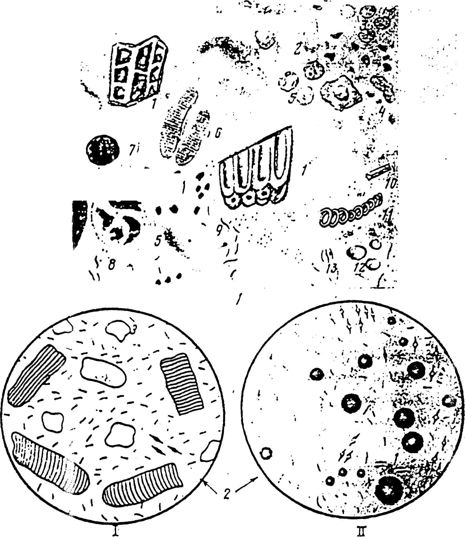 Бактерии в копрограмме. Микроскопия кала атлас клетчатка. Атлас копрограмма микроскопия. Клетчатка непереваримая микроскопия. Копрограмма микроскопия исследование.