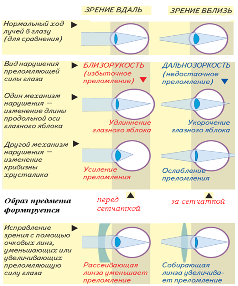 Минус 2 это какое зрение