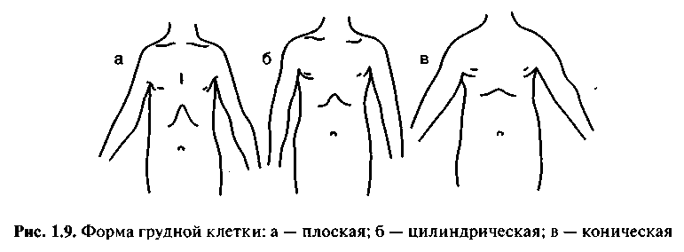 Формы грудной клетки. Соматоскопия форма грудной клетки. Уплощенная форма грудной клетки. Формы грудной клетки коническая цилиндрическая уплощённая. Коническая цилиндрическая и плоская грудная клетка.