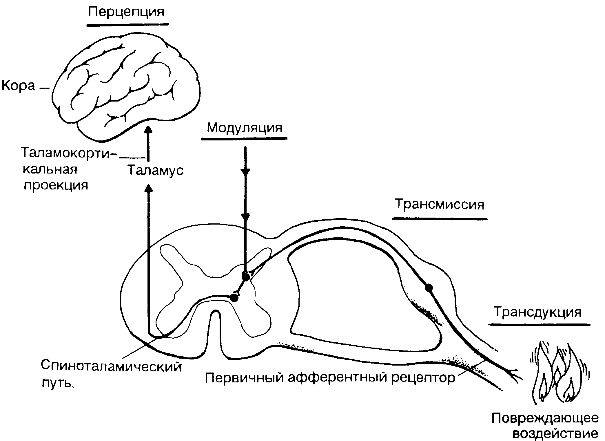 Основные механизмы боли схема