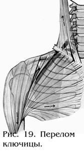 Глава 3 Переломы, вывихи и заболевания плечевого пояса и верхней конечности