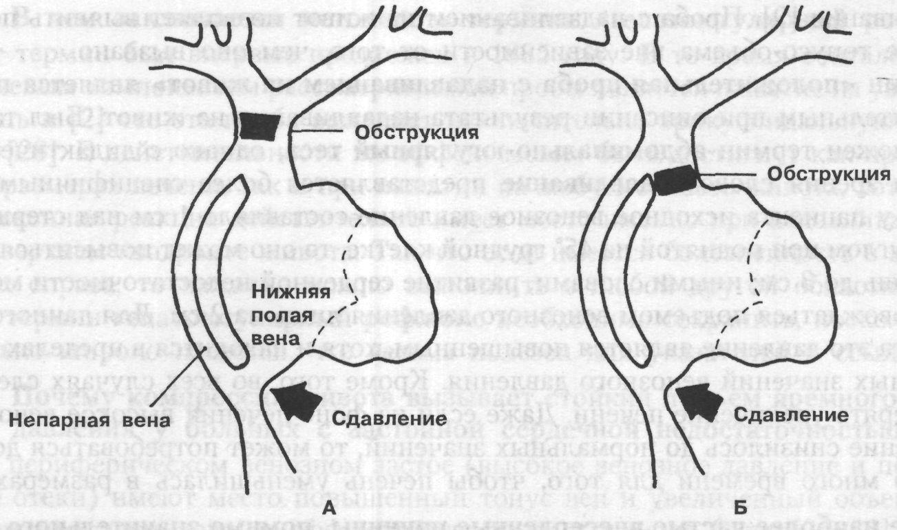 Где находится полая вена во время беременности