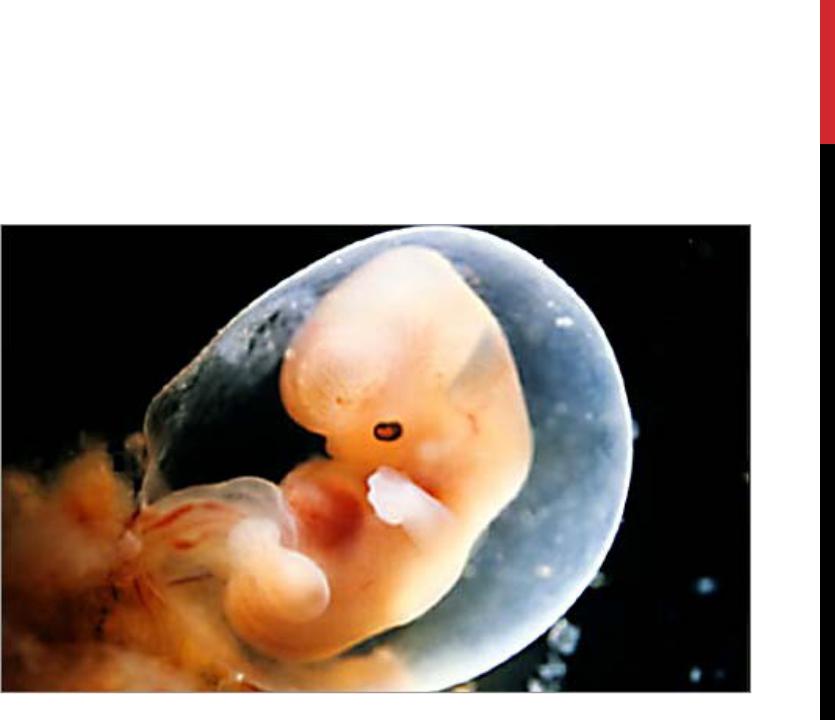 8 недель как выглядит плод. Эмбрион по неделям беременности 6-7 недель. Человеческий зародыш 6 недель. Эмбрион человека 5-6 недель.