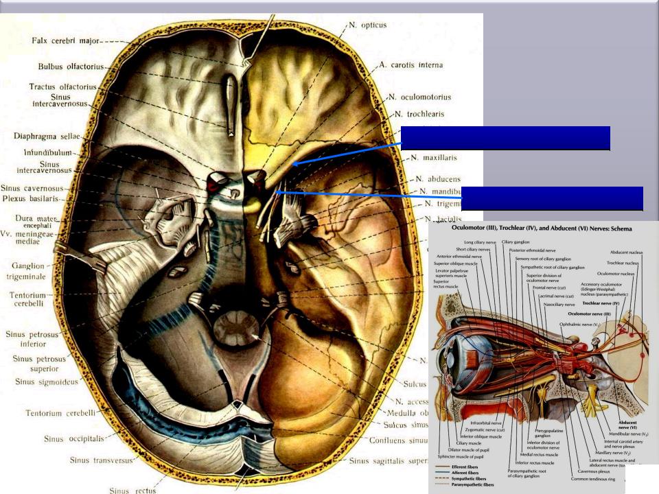 Верхняя глазничная щель. Структуры проходящие через нижнюю глазничную щель. N Opticus верхняя глазничная щель. Верхняя глазничная щель содержимое.