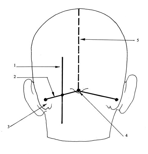 Линия затылка. Сагиттальная линия головы. Проекционные линии черепа. Срединная линия головы. Схема черепно-мозговой топографии.