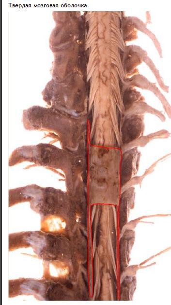 Конский хвост у человека в позвоночнике фото и что это такое