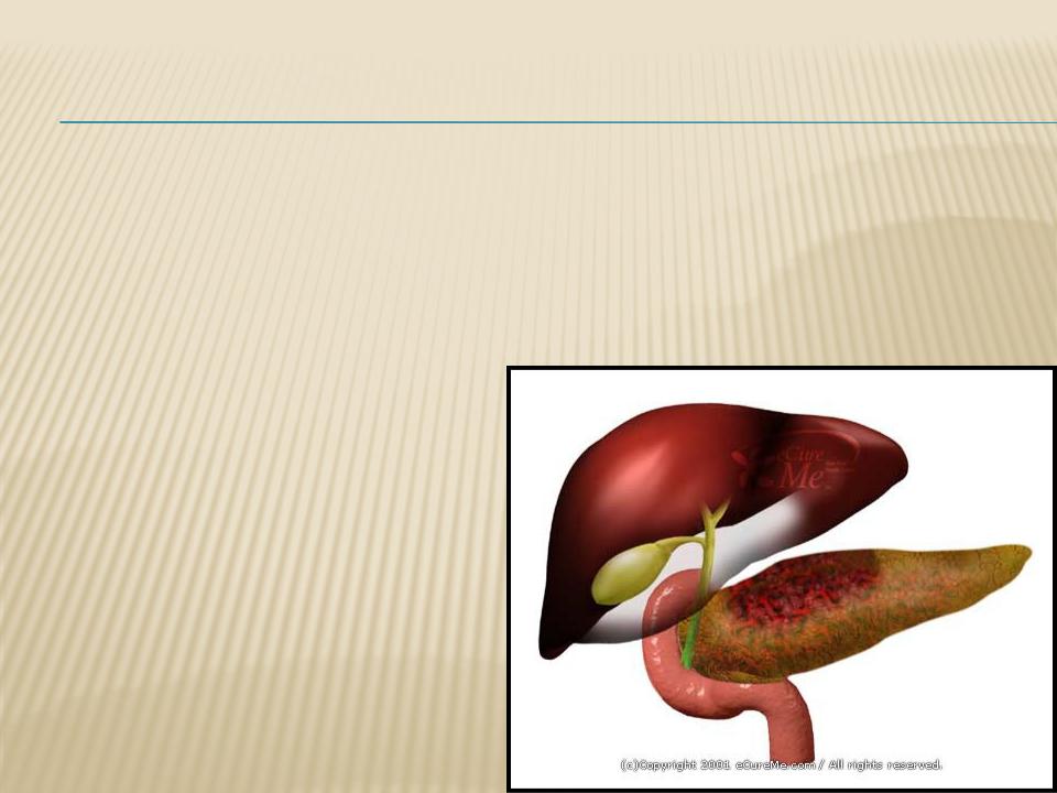 Методы диагностики панкреатита презентация thumbnail