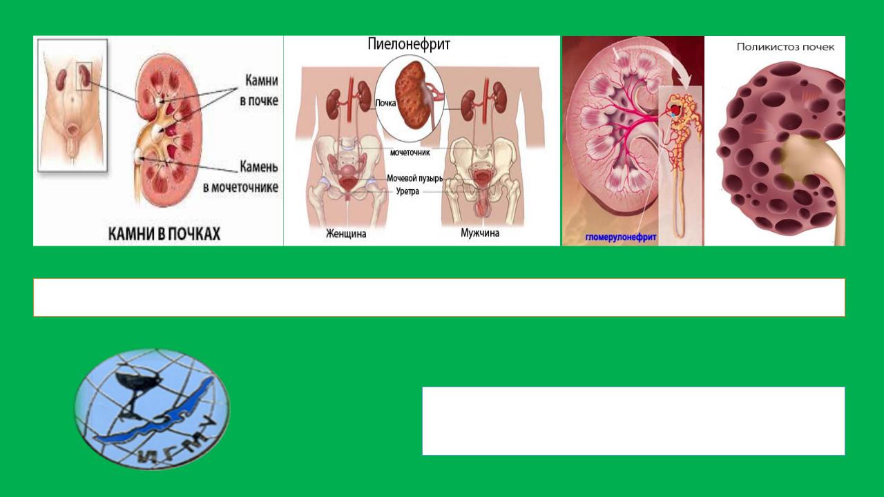Почечные синдромы пропедевтика внутренних болезней