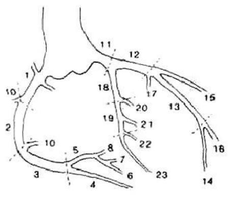 Схема коронарных артерий сердца по сегментам