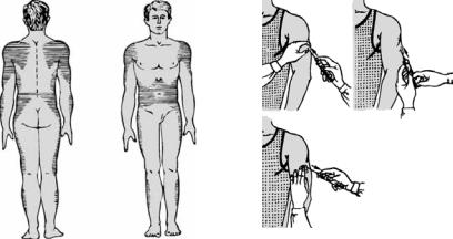 Техника выполнения подкожной инъекции схема