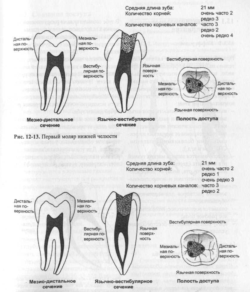 Как называются корни зубов. 1 Моляр нижней челюсти анатомия корневых каналов. 1 Моляр нижней челюсти эндодонтия. Назовите корневые каналы моляра нижней челюсти. Названия корневых каналов в молярах верхней челюсти.