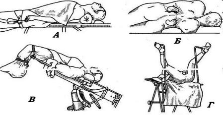 Укладка больного на операционном столе при различных операциях