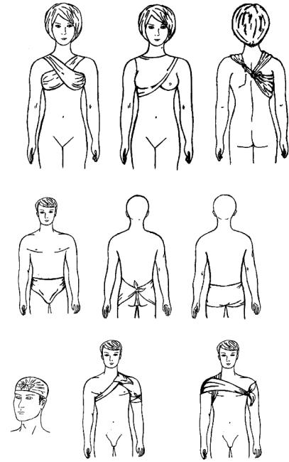 Повязка на молочную железу. Косыночная повязка на молочные железы. Косыночная повязка на молочные железы 1. Косыночная на молочную железу. Косыночная повязка на молочную железу алгоритм.