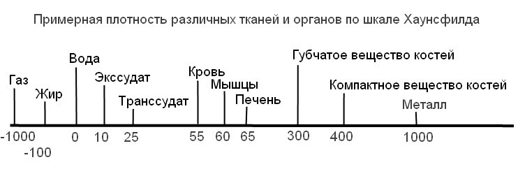 Плотность печени hu. Шкала Хаунсфилда при компьютерной томографии таблица. Плотность по шкале Хаунсфилда. Плотность тканей по шкале Хаунсфилда. Плотность костной ткани по шкале Хаунсфилда.