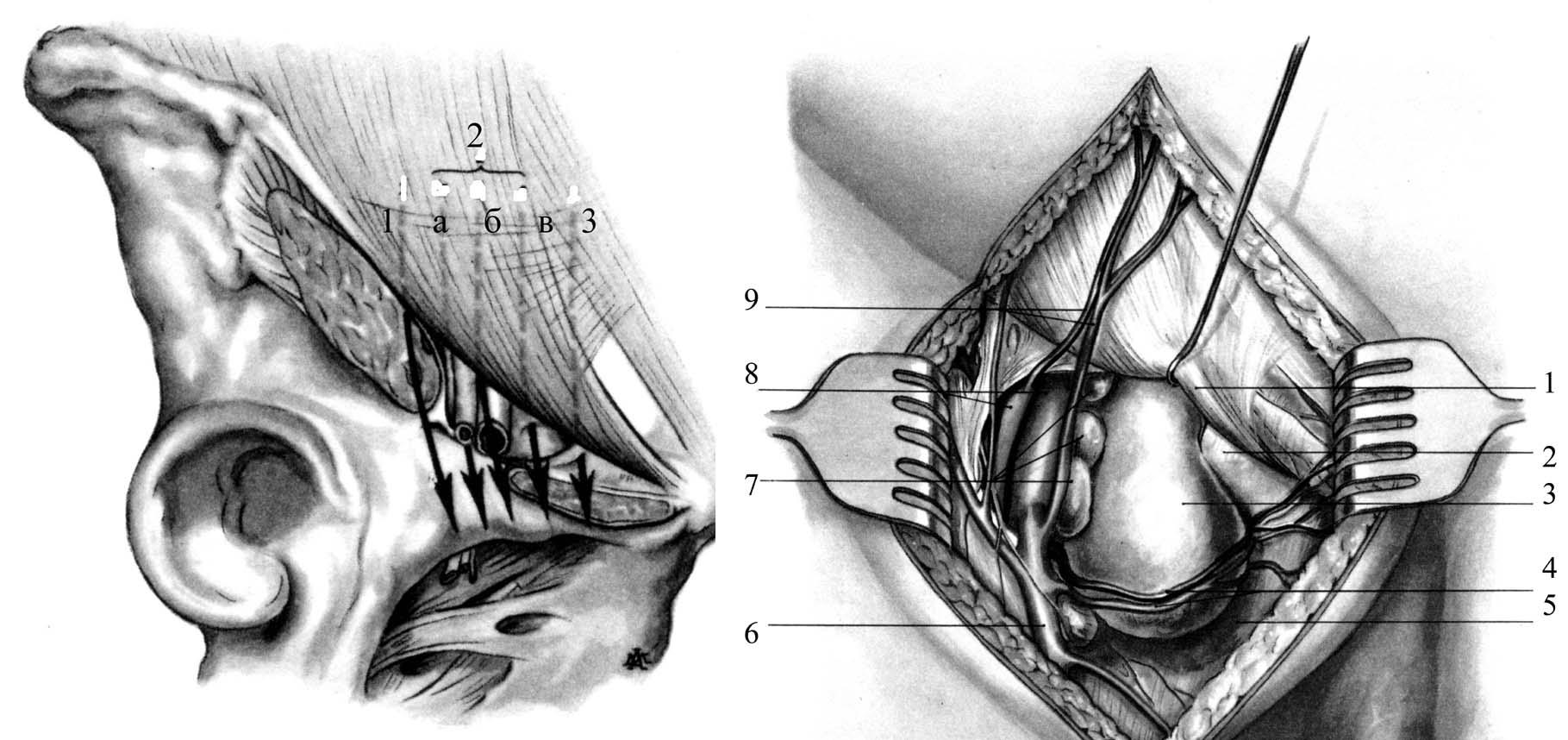 Бедренная грыжа топографическая анатомия thumbnail