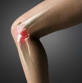 Реферат при артрозе коленного сустава