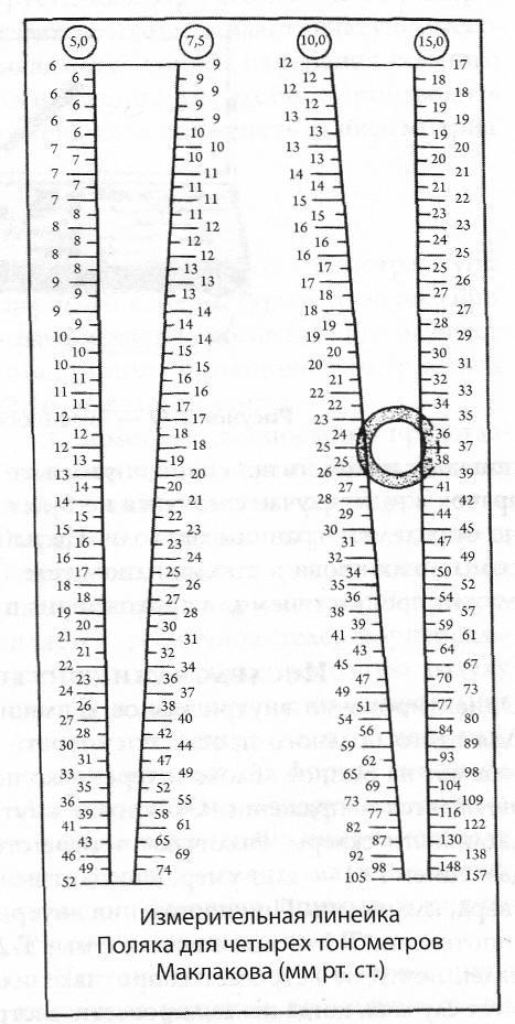 Анализ линейки. Тонометрия ВГД по маклакову. Измерение внутриглазного давления тонометром Маклакова. Измерение внутриглазного давления по маклакову норма. Линейка для измерения ВГД по маклакову.