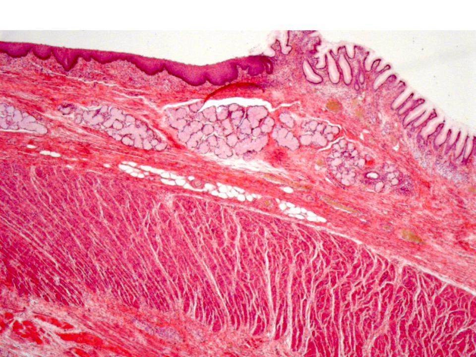 Гистология желудка. Пищевод гистология препарат. Функции пищевода гистология. Пищевод. Желудок гистология препараты. Переход пищевода в желудок препарат гистология.
