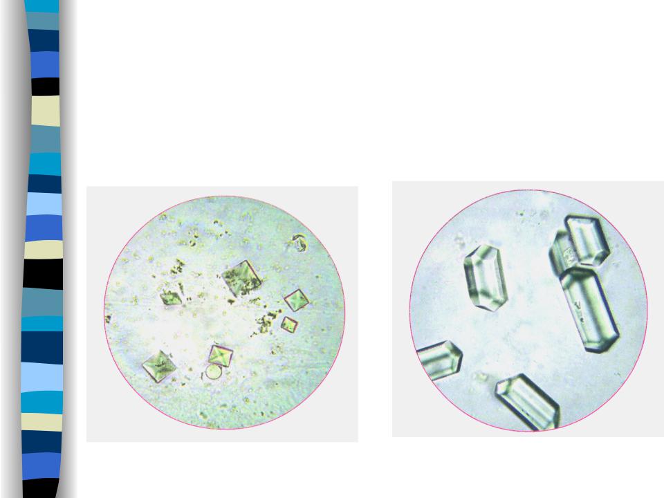 Фосфаты в какой моче. Струвиты оксалаты трипельфосфаты. Микроскопия осадка мочи трипельфосфаты. Микроскопия мочи трипельфосфаты. Оксалаты трипельфосфаты.