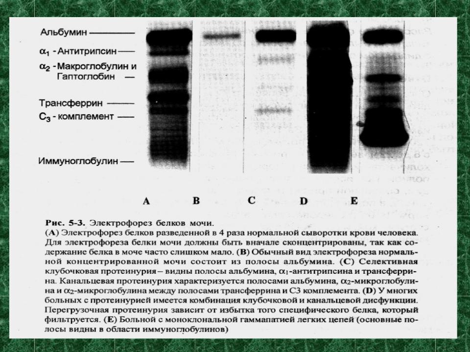 Презентация на тему: ЦИЛИНДРУРИЯ