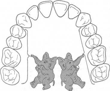 Смещение зубов при ортодонтическом лечение