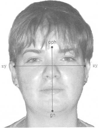 Замер какое лицо. Антропометрические точки ТРГ. Антропометрическое исследование лица. Антропометрическое исследования лица и головы. Морфологическая высота лица.