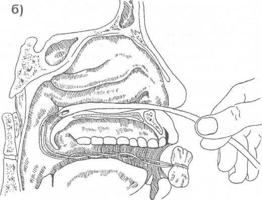 Перелом костей носа классификация
