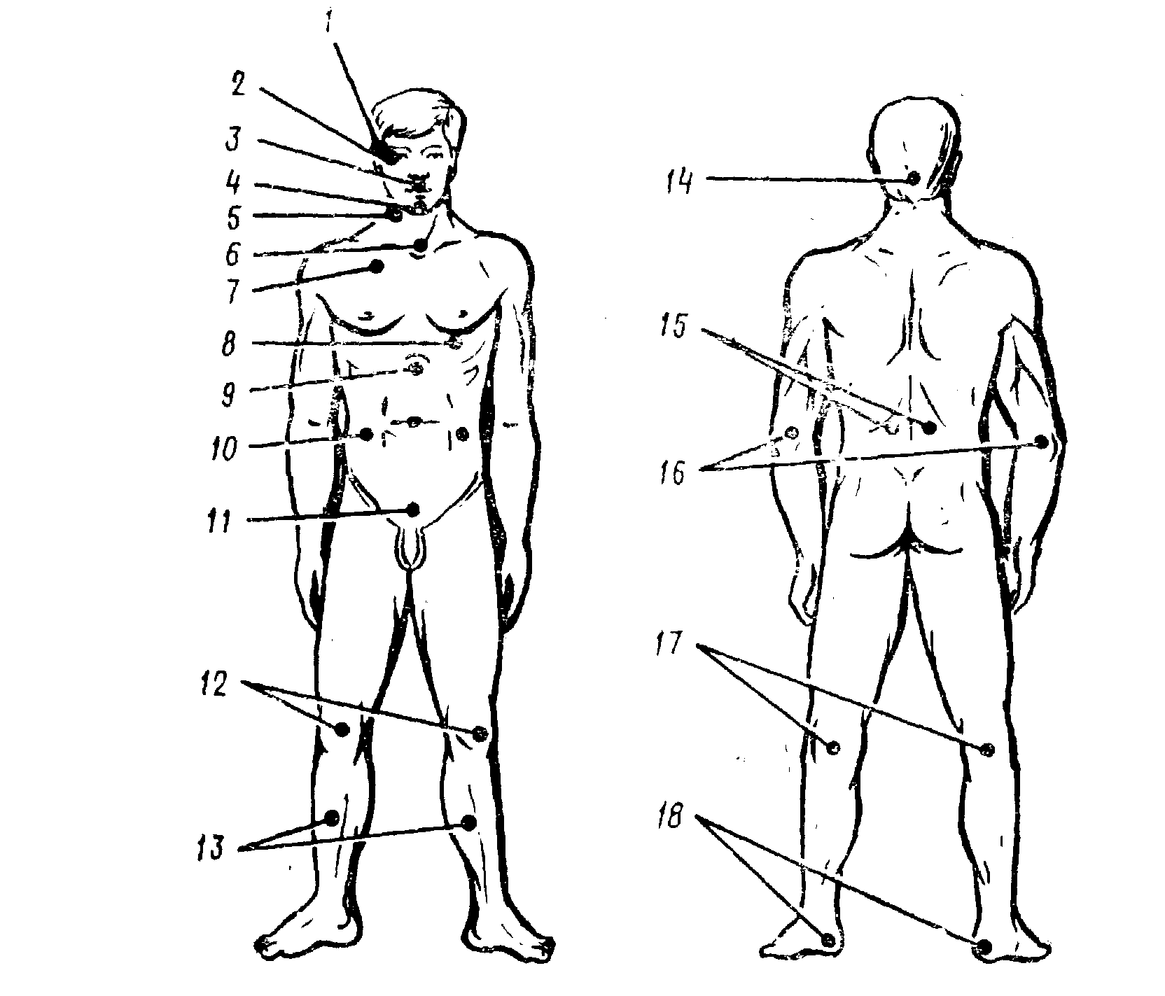 Названия точек человека. Болевые точки и зоны человека. Основные болевые точки на теле человека. Уязвимые точки на теле человека. Самые больные точки человека.