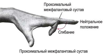 Проксимальные межфаланговые суставы кисти фото