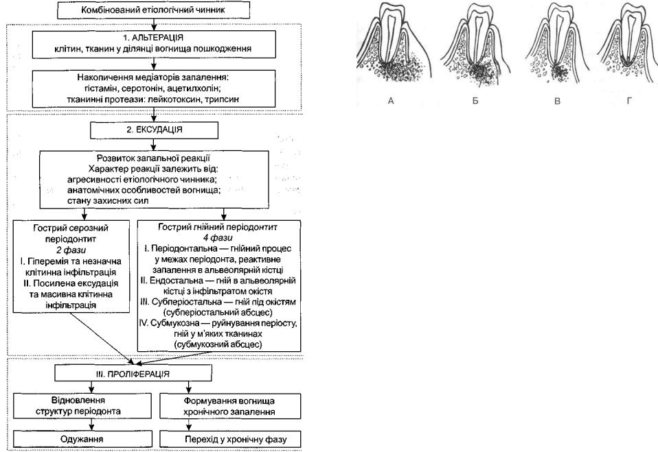 Этиология острого периодонтита. Схема патогенеза острого и хронического периодонтита. Патогенез хронического периодонтита схема. Патогенез периодонтита схема. Патогенез периодонтита таблица.