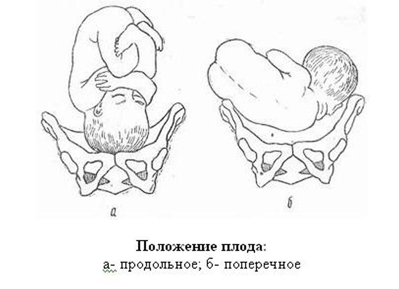 Акушерская терминология