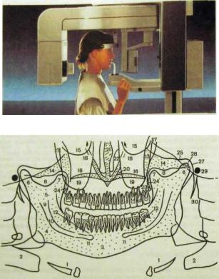 Схема описания ортопантомограммы