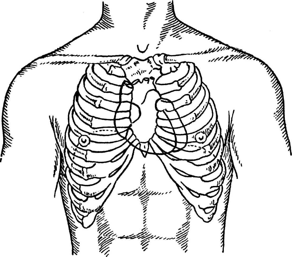 Клапаны сердца на грудной клетке. Топография ребер грудной клетки. Топографическая анатомия грудной клетки человека. Топография грудины клетки. Мечевидный отросток анатомия.