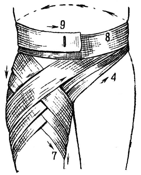 Перевязка ягодицы. Колосовидная повязка на тазобедренный сустав. Колосовидная повязка тазобедренного сустава и бедра. Паховая колосовидная повязка. Восходящая колосовидная повязка на бедро.