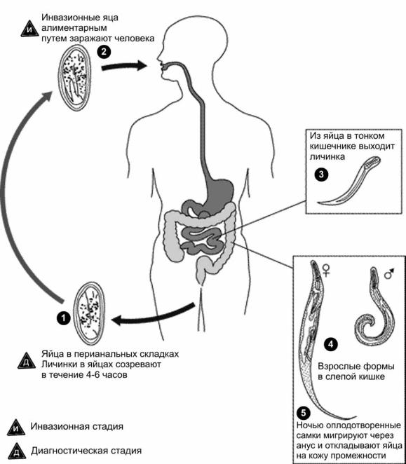 enterobius vermicularis és egy protozoon