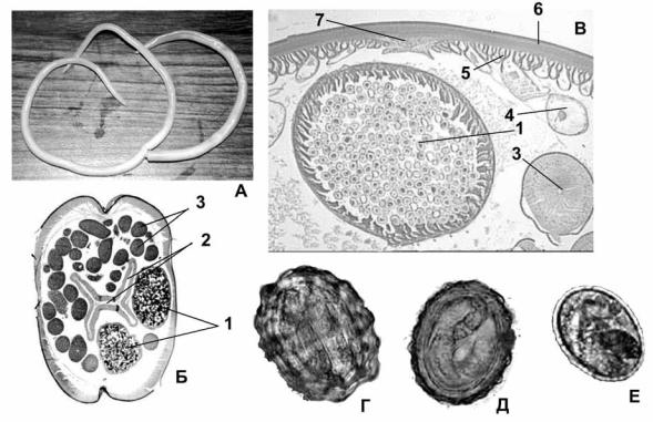 Как выглядит яйцо аскариды фото