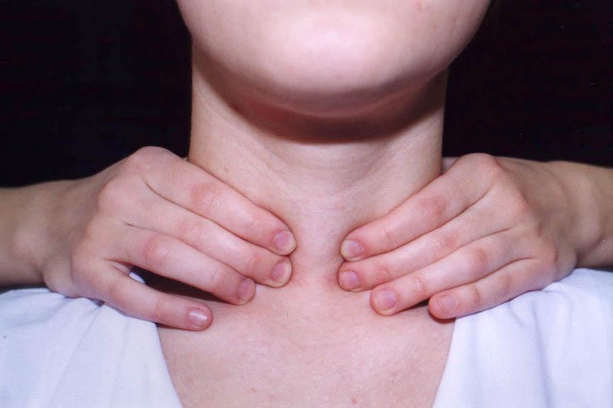Исследование зоба. Методика пальпации щитовидной железы. Зоб щитовидной железы пальпация. Пальпируется перешеек щитовидной железы. Обследование щитовидной железы пальпация.