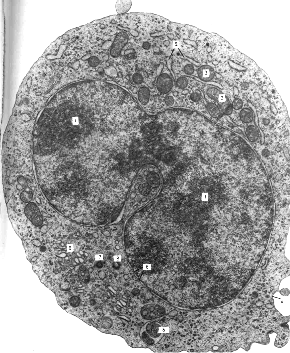Клетки печени мыши. Электронограмма ядра клетки. Ядрышко Электронограмма. Ядро клетки микрофотография. Электронограммы гистология цитология.
