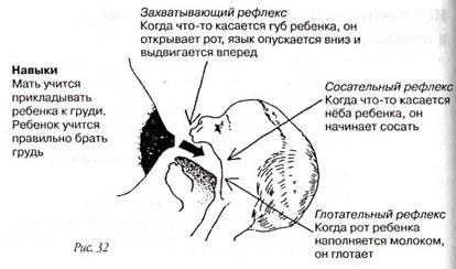 Преждевременные роды