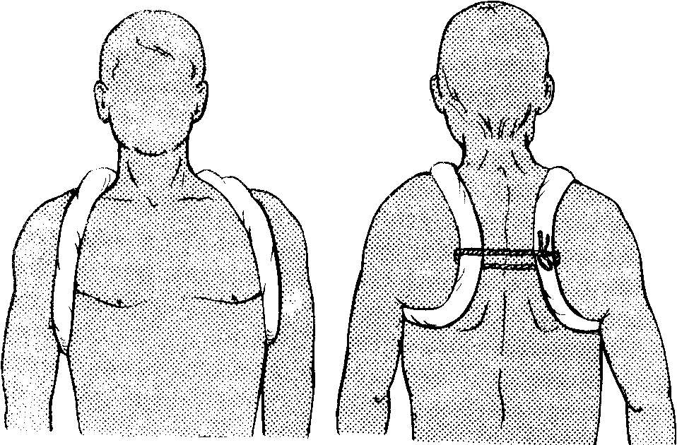 Повреждения надплечья плеча вывихи плеча