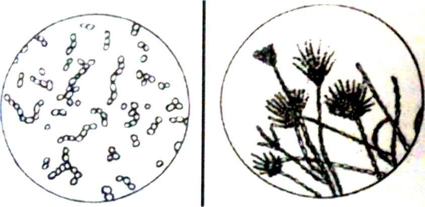 Споры гриба и нити. Дрожжевые грибы микроскопия мочи. Дрожжеподобные грибы в моче микроскопия. Плесневые грибы в моче. Мицелий грибов в моче микроскопия.