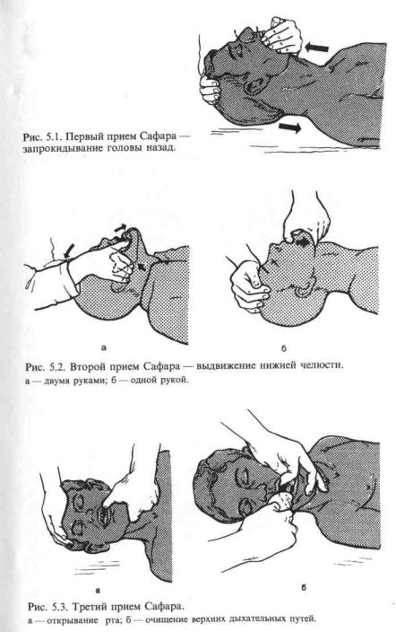 Тройной прием сафара