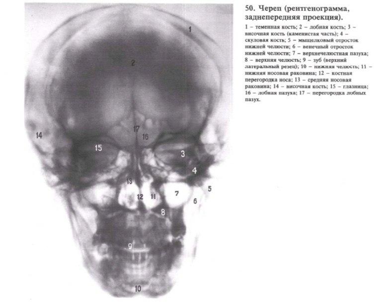 Пазухи черепа человека фото с описанием картинки