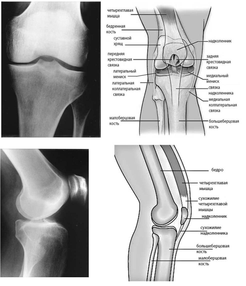 Отек мыщелка бедренной. Строение коленного сустава рентген. Анатомия большеберцовой кости коленного сустава. Периостит коленного сустава рентген. Коленный сустав строение анатомия рентген.