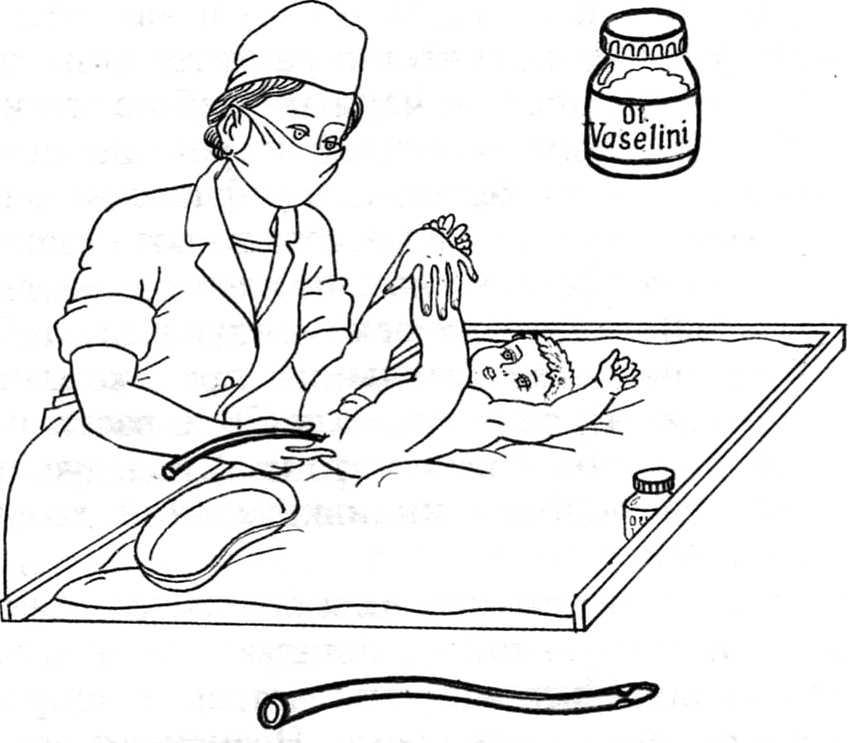 Введение очистительной клизмы. Введение газоотводной трубки новорожденному. Техника введения газоотводной трубки ребенку грудного. Техника постановки очистительной клизмы. Газоотводная трубка алгоритм.