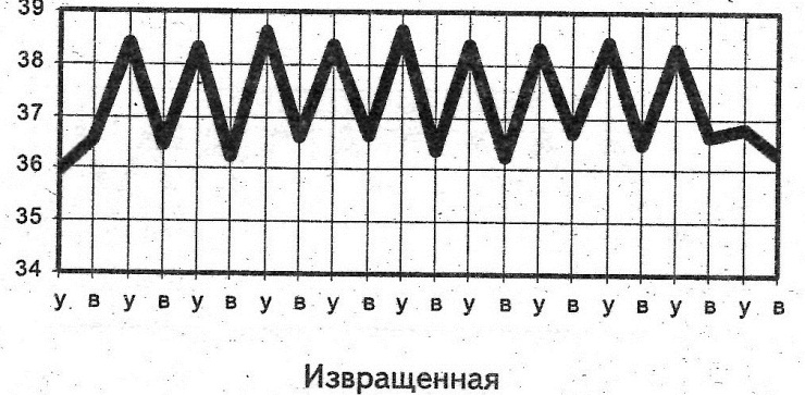 Резкие колебания температуры воздуха