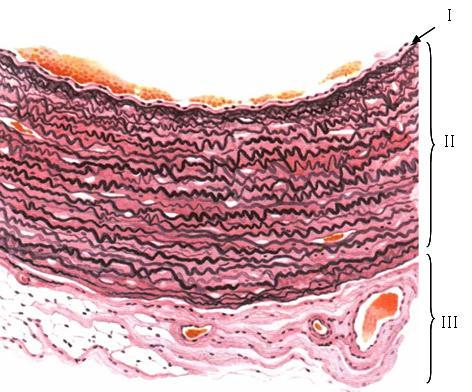 Артерия эластического типа рисунок